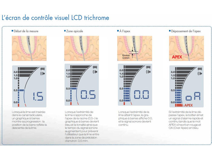 Ecran de contrôle visuel iPexII NSK