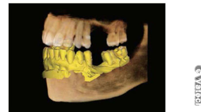CBCT - Â© Vatech
